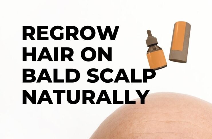 Regrow Hair On Bald Scalp Naturally